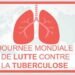 Le 24 mars: Journée internationale de lutte contre la tuberculose